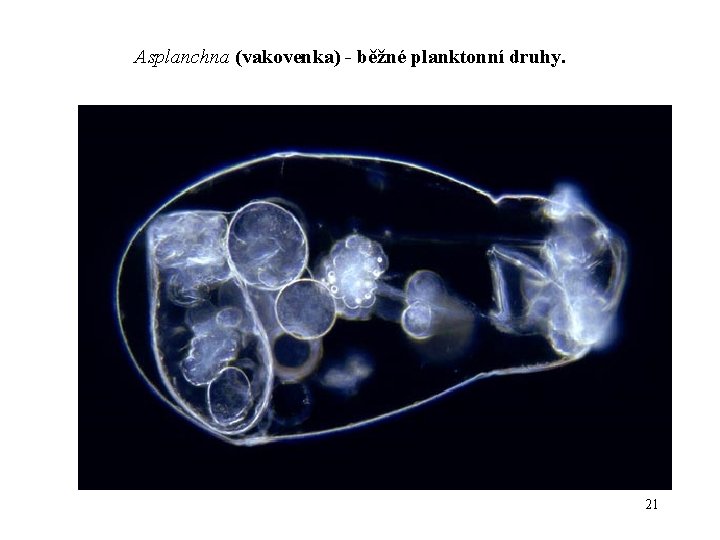 Asplanchna (vakovenka) - běžné planktonní druhy. 21 