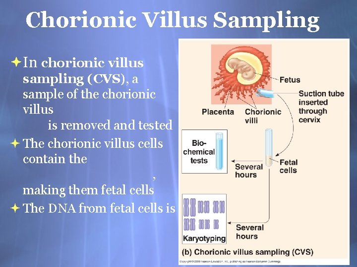 Chorionic Villus Sampling In chorionic villus sampling (CVS), a sample of the chorionic villus