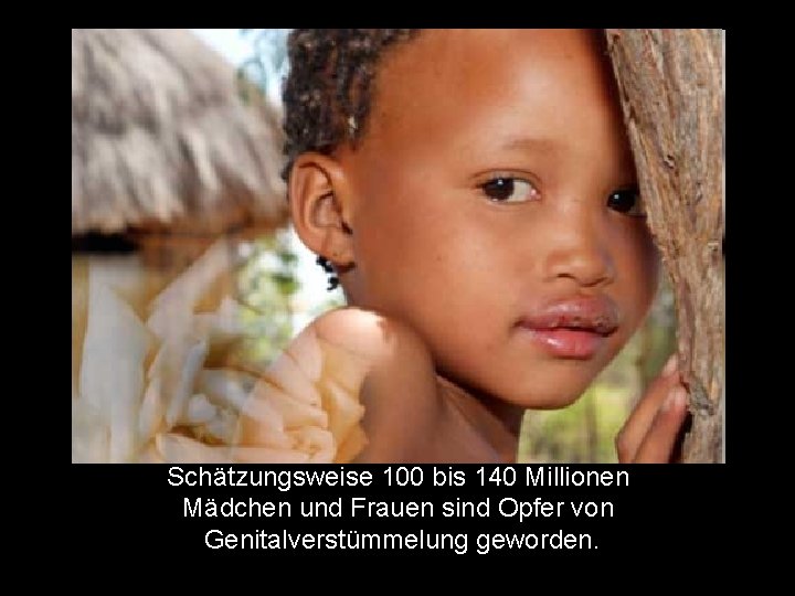 Schätzungsweise 100 bis 140 Millionen Mädchen und Frauen sind Opfer von Genitalverstümmelung geworden. 