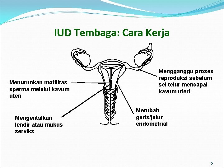 IUD Tembaga: Cara Kerja Menurunkan motilitas sperma melalui kavum uteri Mengentalkan lendir atau mukus