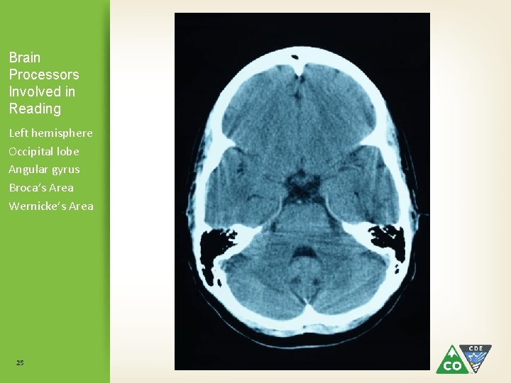 Brain Processors Involved in Reading Left hemisphere Occipital lobe Angular gyrus Broca’s Area Wernicke’s Brain Processors Involved in Reading Left hemisphere Occipital lobe Angular gyrus Broca’s Area Wernicke’s
