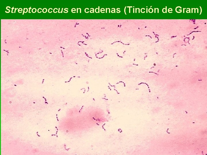 Streptococcus en cadenas (Tinción de Gram) 