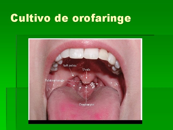 Cultivo de orofaringe 