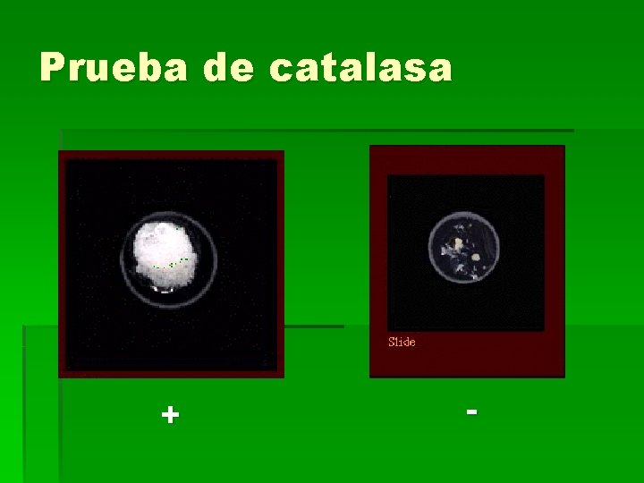 Prueba de catalasa + - 