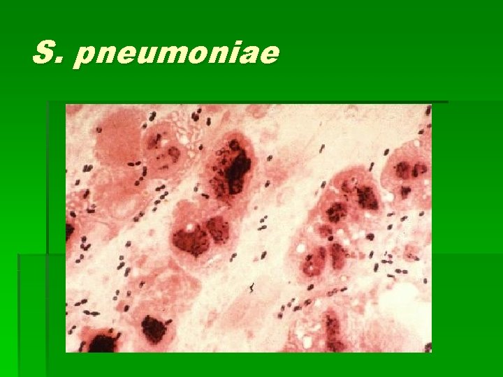 S. pneumoniae 