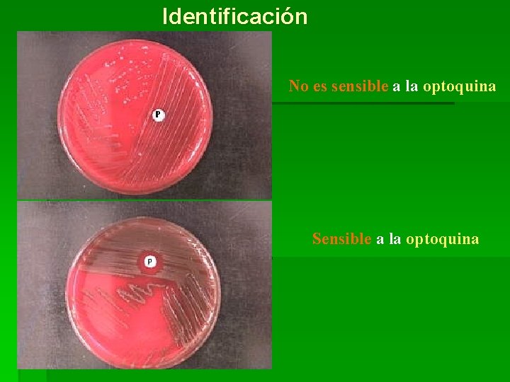 Identificación No es sensible a la optoquina Sensible a la optoquina 