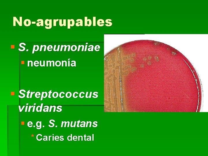 No-agrupables § S. pneumoniae § neumonía § Streptococcus viridans § e. g. S. mutans