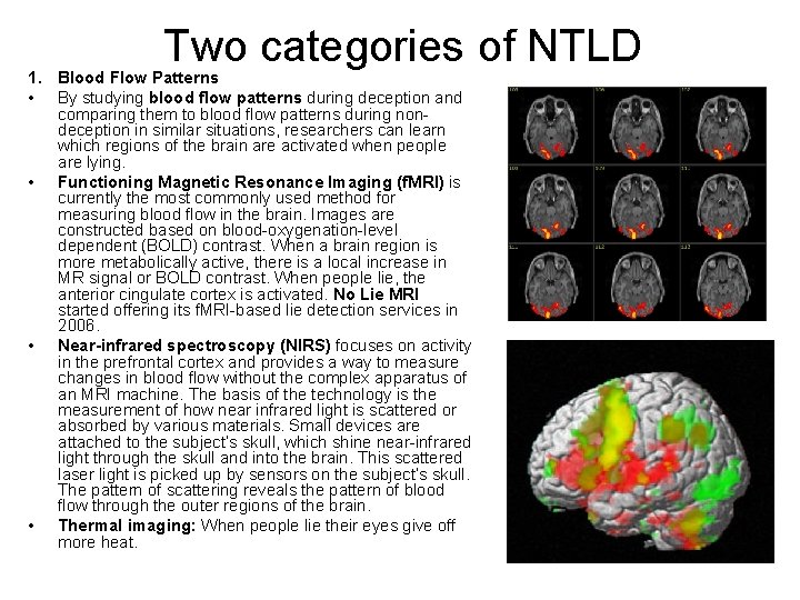 Two categories of NTLD 1. Blood Flow Patterns • By studying blood flow patterns