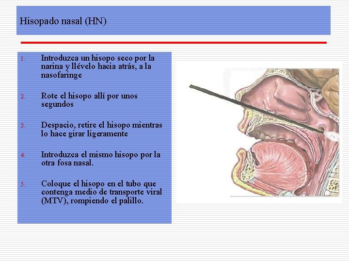 Hisopado nasal (HN) 1. Introduzca un hisopo seco por la narina y llévelo hacia