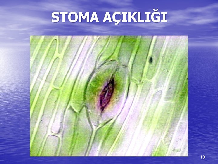 STOMA AÇIKLIĞI 19 