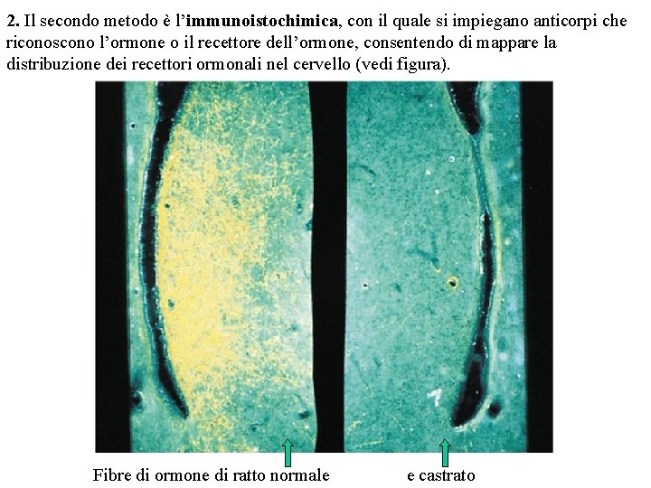 2. Il secondo metodo è l’immunoistochimica, con il quale si impiegano anticorpi che riconoscono