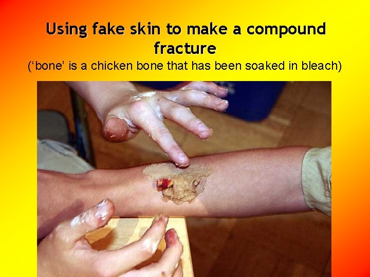 Using fake skin to make a compound fracture (‘bone’ is a chicken bone that