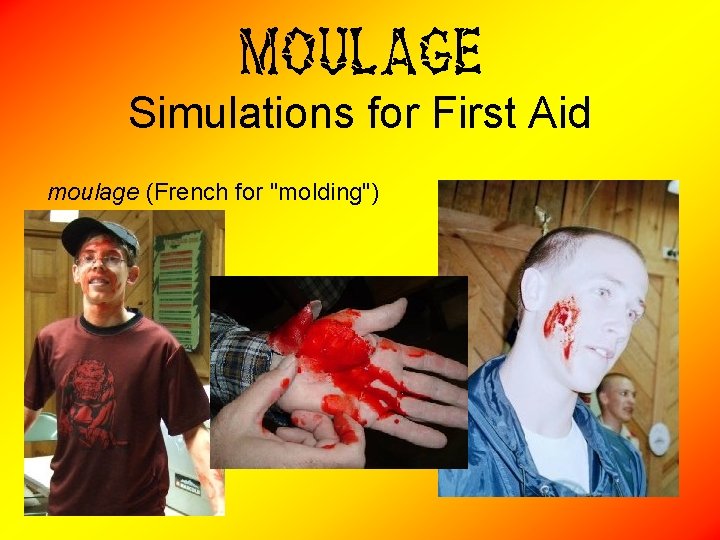 Moulage Simulations for First Aid moulage (French for "molding") 