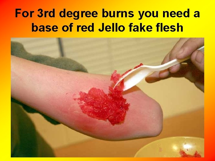 For 3 rd degree burns you need a base of red Jello fake flesh