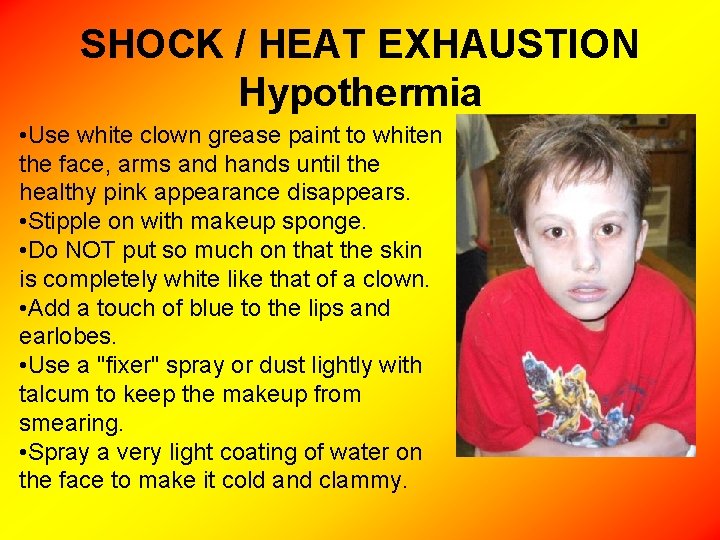 SHOCK / HEAT EXHAUSTION Hypothermia • Use white clown grease paint to whiten the