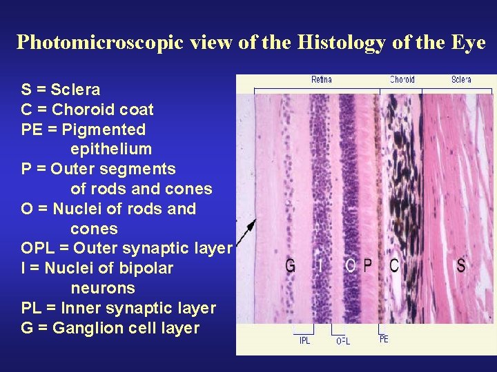 Photomicroscopic view of the Histology of the Eye S = Sclera C = Choroid