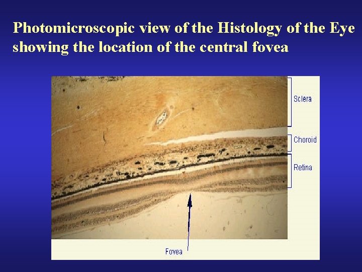 Photomicroscopic view of the Histology of the Eye showing the location of the central
