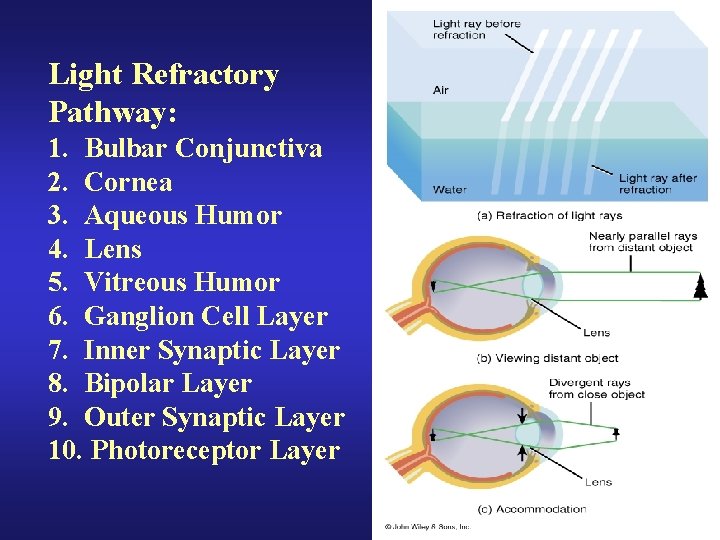 Light Refractory Pathway: 1. Bulbar Conjunctiva 2. Cornea 3. Aqueous Humor 4. Lens 5.