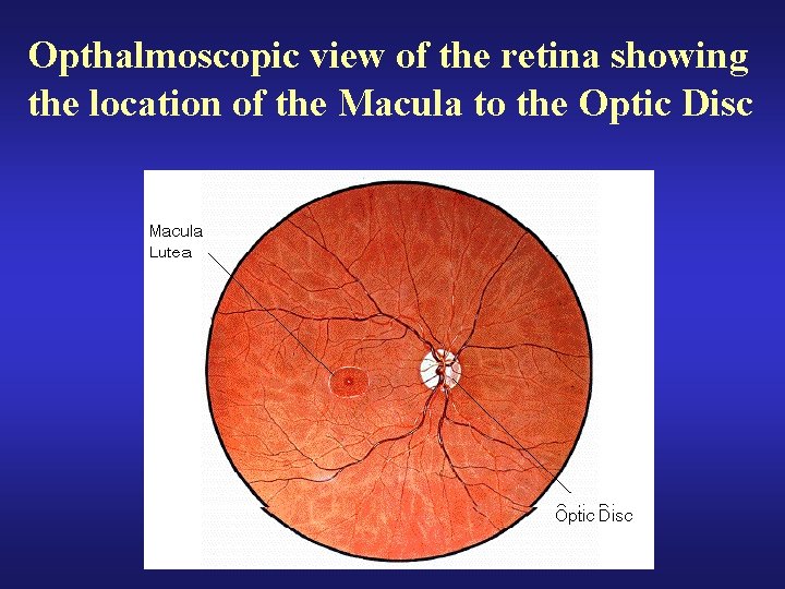 Opthalmoscopic view of the retina showing the location of the Macula to the Optic