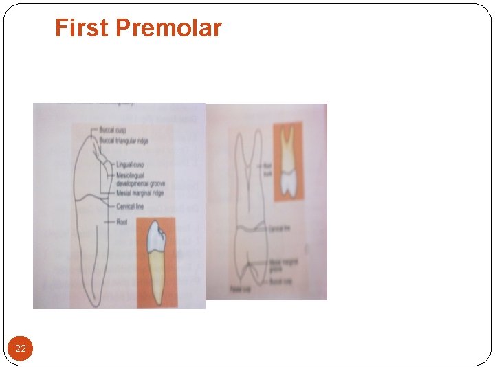 First Premolar 22 First Premolar 22