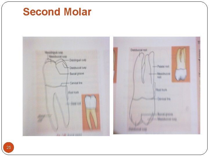 Second Molar 25 Second Molar 25