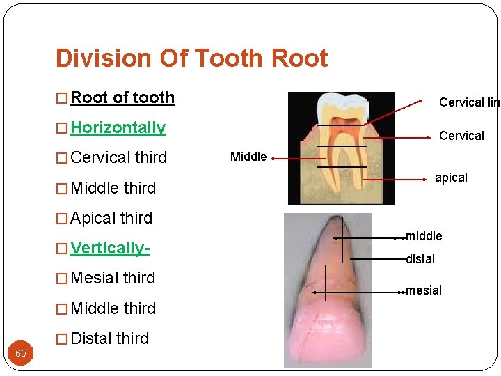 Division Of Tooth Root � Root of tooth Cervical line � Horizontally Cervical � Division Of Tooth Root � Root of tooth Cervical line � Horizontally Cervical �