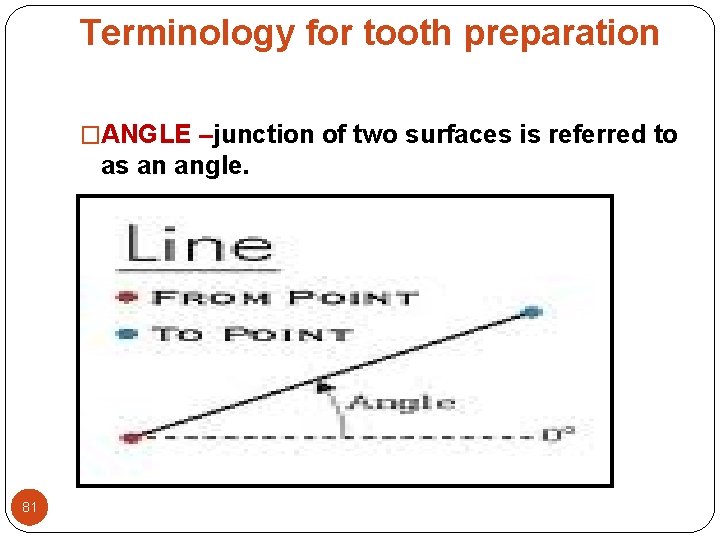 Terminology for tooth preparation �ANGLE –junction of two surfaces is referred to as an Terminology for tooth preparation �ANGLE –junction of two surfaces is referred to as an