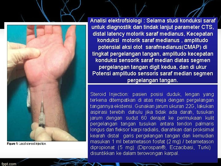 Analisi elektrofsiologi : Selama studi konduksi saraf untuk diagnostik dan tindak lanjut parameter CTS,