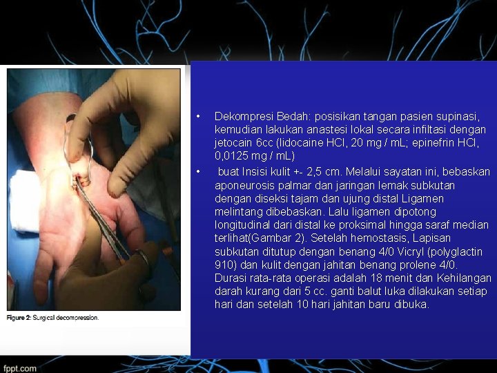  • • Dekompresi Bedah: posisikan tangan pasien supinasi, kemudian lakukan anastesi lokal secara