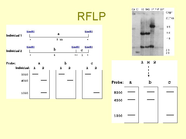 RFLP 