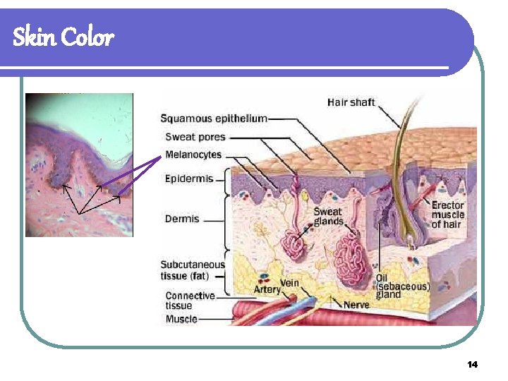 Skin Color 14 