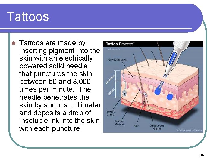 Tattoos l Tattoos are made by inserting pigment into the skin with an electrically