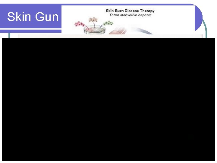 Skin Gun 62 