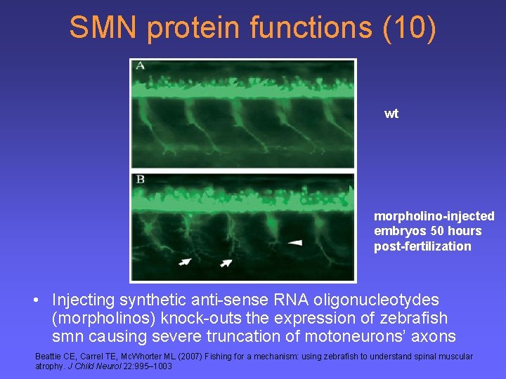 SMN protein functions (10) wt morpholino-injected embryos 50 hours post-fertilization • Injecting synthetic anti-sense