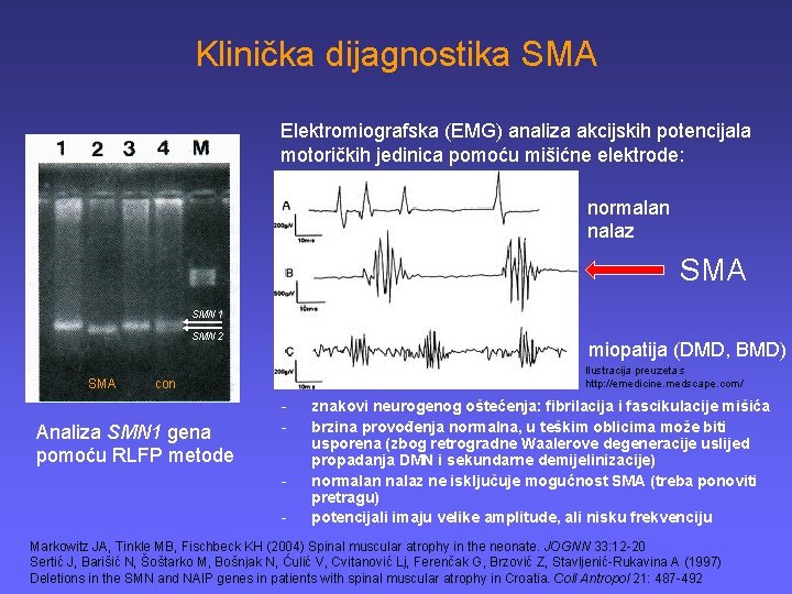 Klinička dijagnostika SMA Elektromiografska (EMG) analiza akcijskih potencijala motoričkih jedinica pomoću mišićne elektrode: motoričke