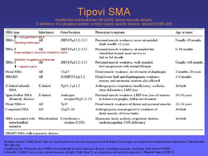 Tipovi SMA modificirano prema Monani UR (2005) Spinal muscular atrophy. A deficiency in a