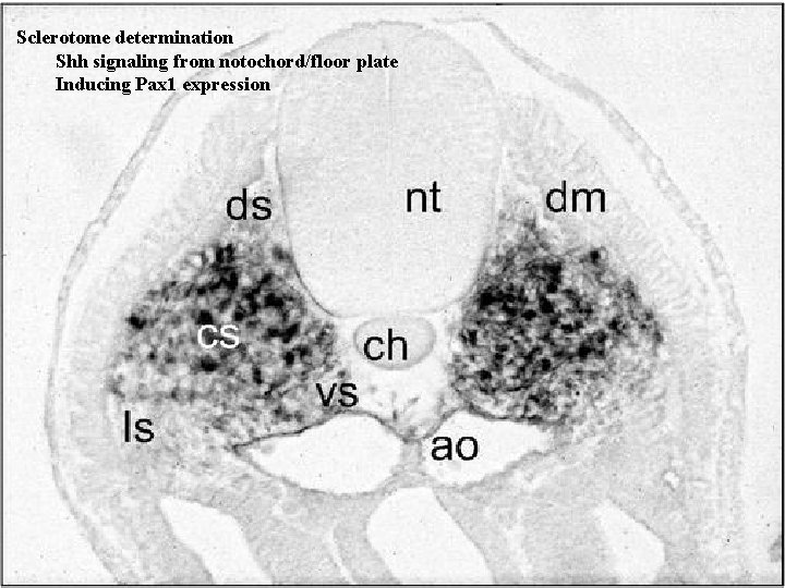 Sclerotome determination Shh signaling from notochord/floor plate Inducing Pax 1 expression 