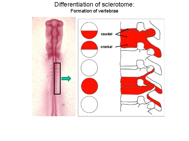 Differentiation of sclerotome: Formation of vertebrae caudal cranial 
