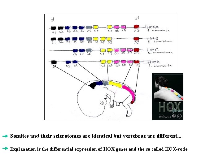 Somites and their sclerotomes are identical but vertebrae are different. . . Explanation is