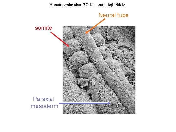 Humán embrióban 37 -40 somita fejlődik ki Paraxial mesoderm Neural tube somite Paraxial mesoderm