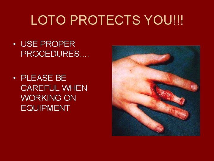 LOTO PROTECTS YOU!!! • USE PROPER PROCEDURES…. • PLEASE BE CAREFUL WHEN WORKING ON