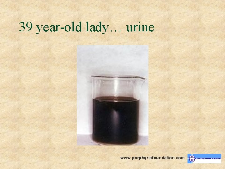 39 year-old lady… urine www. porphyriafoundation. com 