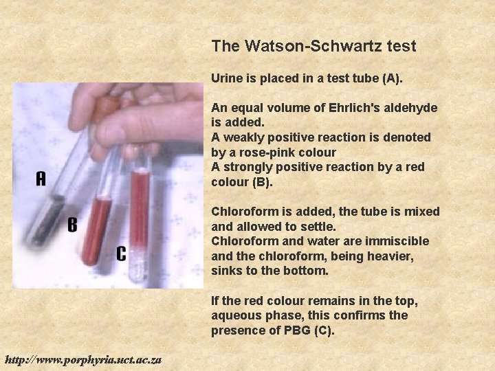 The Watson-Schwartz test Urine is placed in a test tube (A). An equal volume