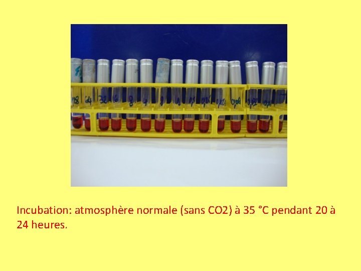 Incubation: atmosphère normale (sans CO 2) à 35 °C pendant 20 à 24 heures. Incubation: atmosphère normale (sans CO 2) à 35 °C pendant 20 à 24 heures.