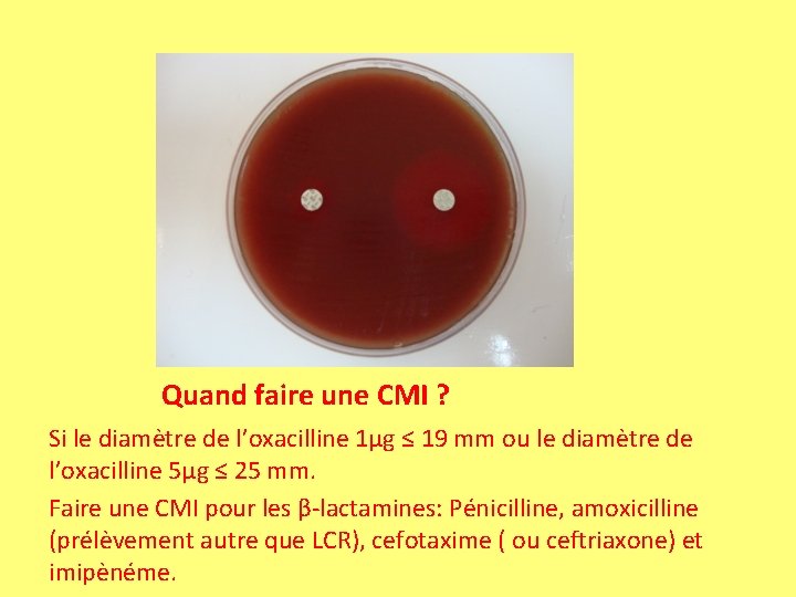 Quand faire une CMI ? Si le diamètre de l’oxacilline 1µg ≤ 19 mm Quand faire une CMI ? Si le diamètre de l’oxacilline 1µg ≤ 19 mm