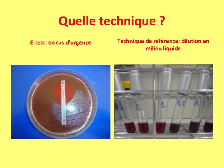Quelle technique ? E-test: en cas d’urgence Technique de référence: dilution en milieu liquide Quelle technique ? E-test: en cas d’urgence Technique de référence: dilution en milieu liquide