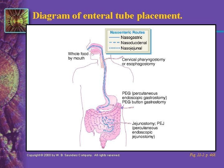 Diagram of enteral tube placement. Copyright © 2000 by W. B. Saunders Company. All