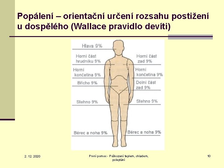 Popálení – orientační určení rozsahu postižení u dospělého (Wallace pravidlo devíti) 2. 12. 2020