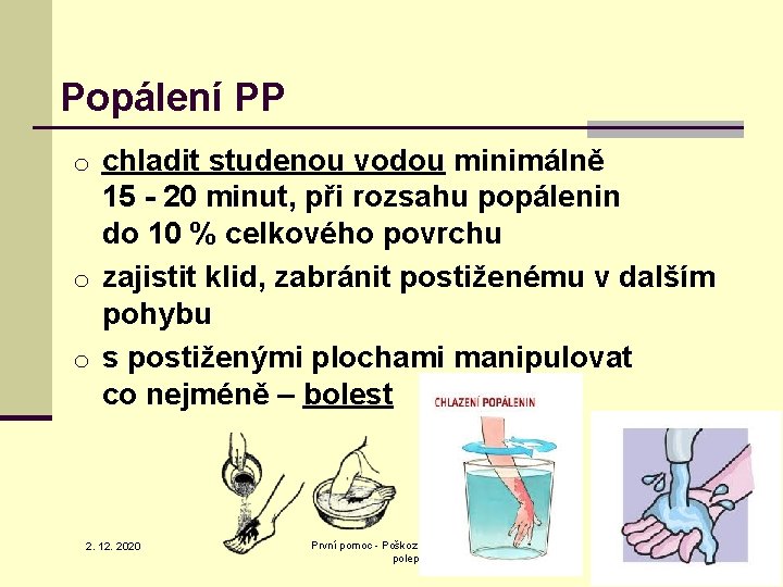 Popálení PP o chladit studenou vodou minimálně 15 - 20 minut, při rozsahu popálenin