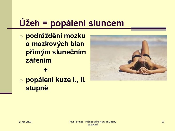 Úžeh = popálení sluncem o podráždění mozku a mozkových blan přímým slunečním zářením +